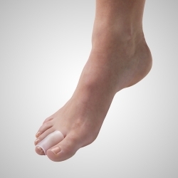 Separatore interdigitale a...